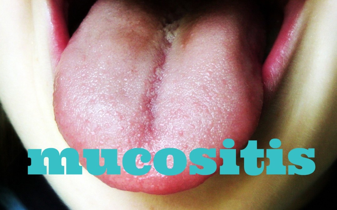 Mucositis and mouth ulcers