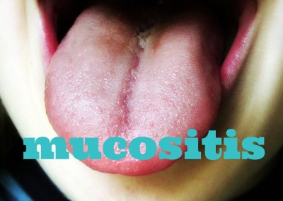 Mucositis and mouth ulcers